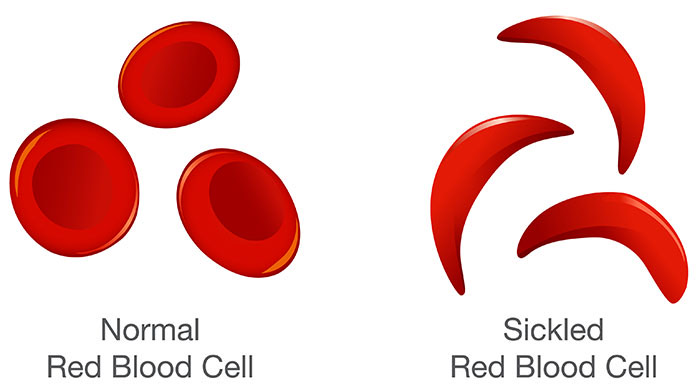 Living Through The Pain—Cell WARRIOR